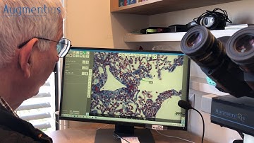 Quantitative evaluation of fibrosis with AI microscope