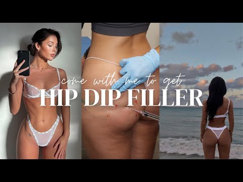 Bbl & Hip Dip Filler