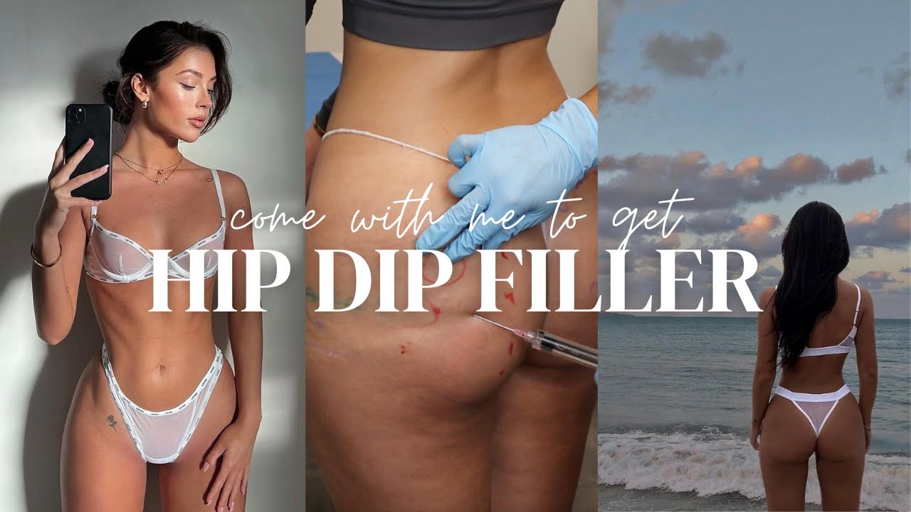 Hip Dip Filler Transformation