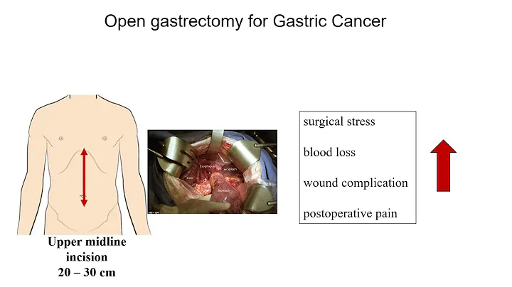 2021 International Gastric Cancer Educational Symp...