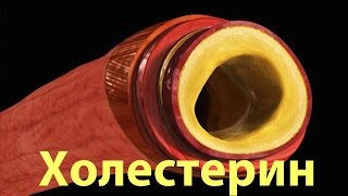 Холестерин Холестерин