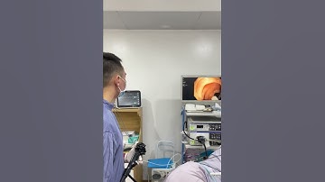 Nội soi cắt Polyp đại tràng.