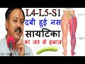 L4-L5-S1, दबी हुई नस, साइटिका, SCIATICA, Hips pain का सफल जड़ से इलाज | Rajiv Dixit | ROHIT KHATI