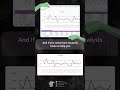 Anomaly Detection with Standard Deviation Quick Guide #dataanlysis