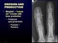 Radiographic Approach to Arthritis