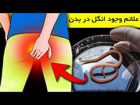 علائمی که فکرش را هم نمیکردید نشانه وجودکرم در معده و روده باشد!