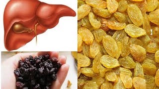 Keey Your Liver Healthy With Raisins/Kismis Fruit || DIY Healthy Ancient Remedies