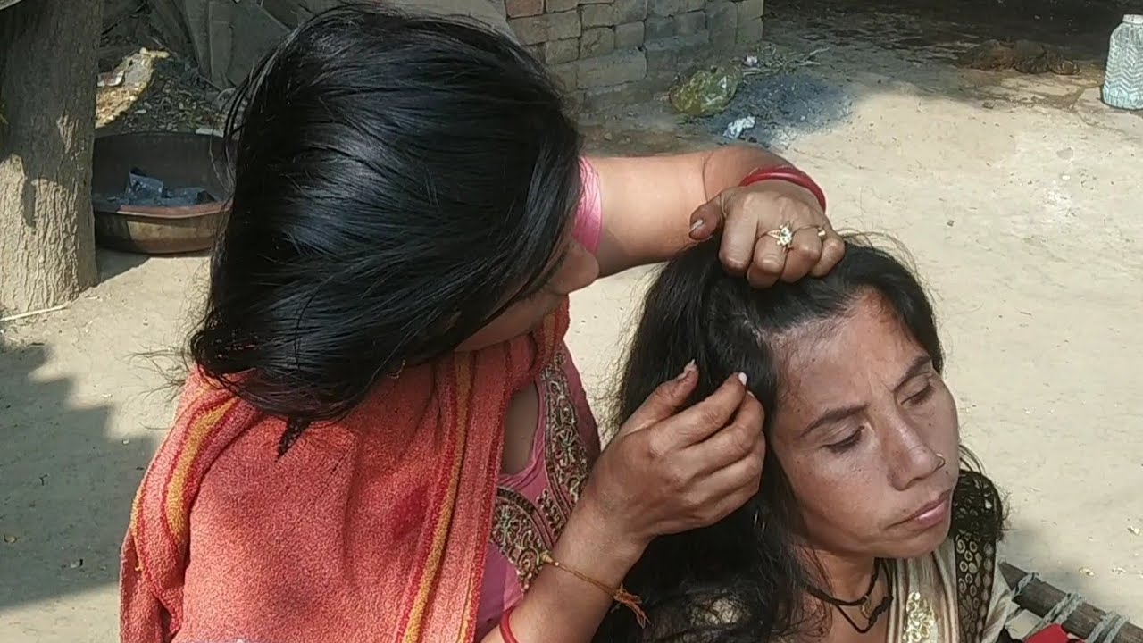 Nitpicking In Long Hair #viral #nitpicking