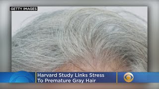 Harvard Study Links Stress To Premature Gray Hair