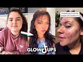 Glow up transformation tiktok compilation before  after