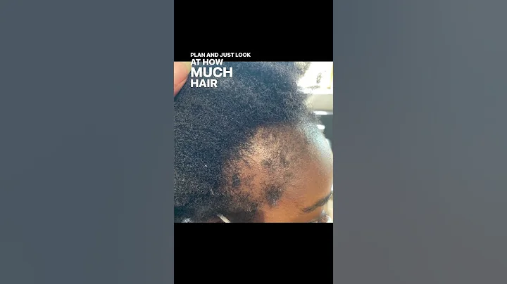 Growing your edges back