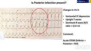 Case studies in ACS (Lecture 71)