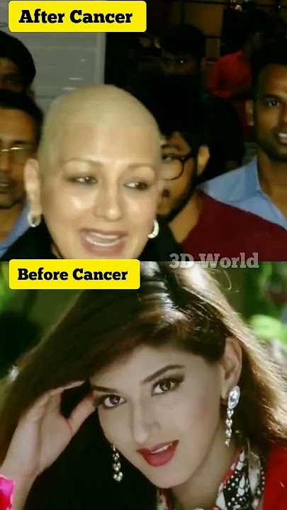 Sonali Bendre Cancer Survivor 😱😭 ll #viral #sonalibendre #shorts