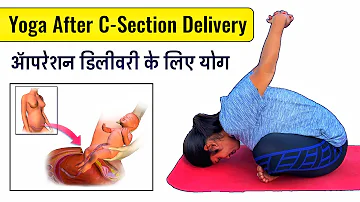 ऑपरेशन डिलीवरी के बाद यह योग करना शुरू कर दें | Yoga for After C Section Delivery | @Yogawale