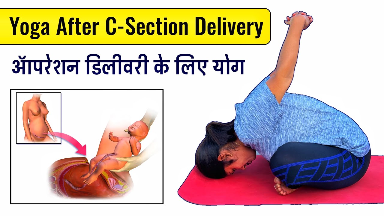 yoga-for-after-c