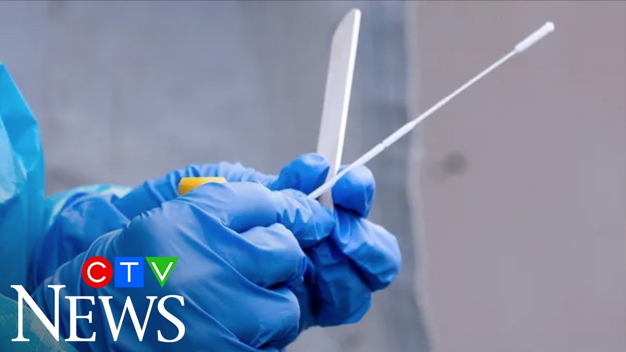 Clusters of COVID-19 cases changing virus age demographics