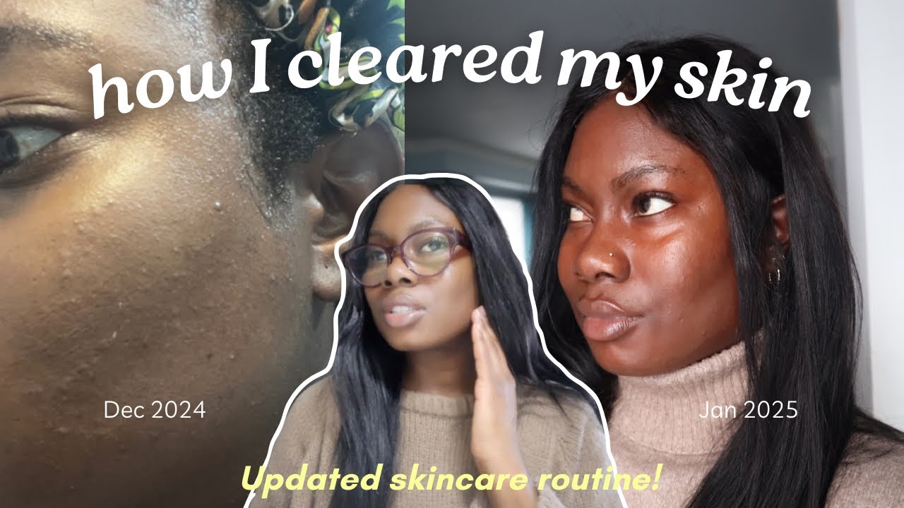 MY UPDATED SKINCARE ROUTINE | how I cleared my skin, affordable ...