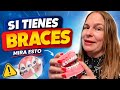  ¿Tienes braces? El error #1 que causa caries y encías inflamadas (evítalo ya)