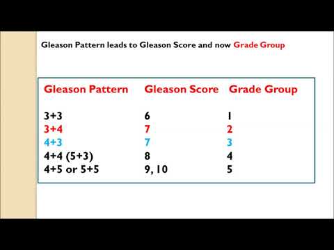 Prostate Cancer and Gleason Score or Group Video
