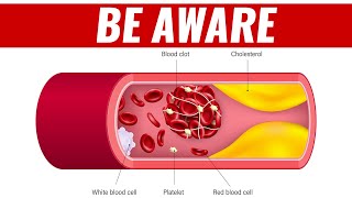 Why are BLOOD CLOTS so DANGEROUS right NOW?