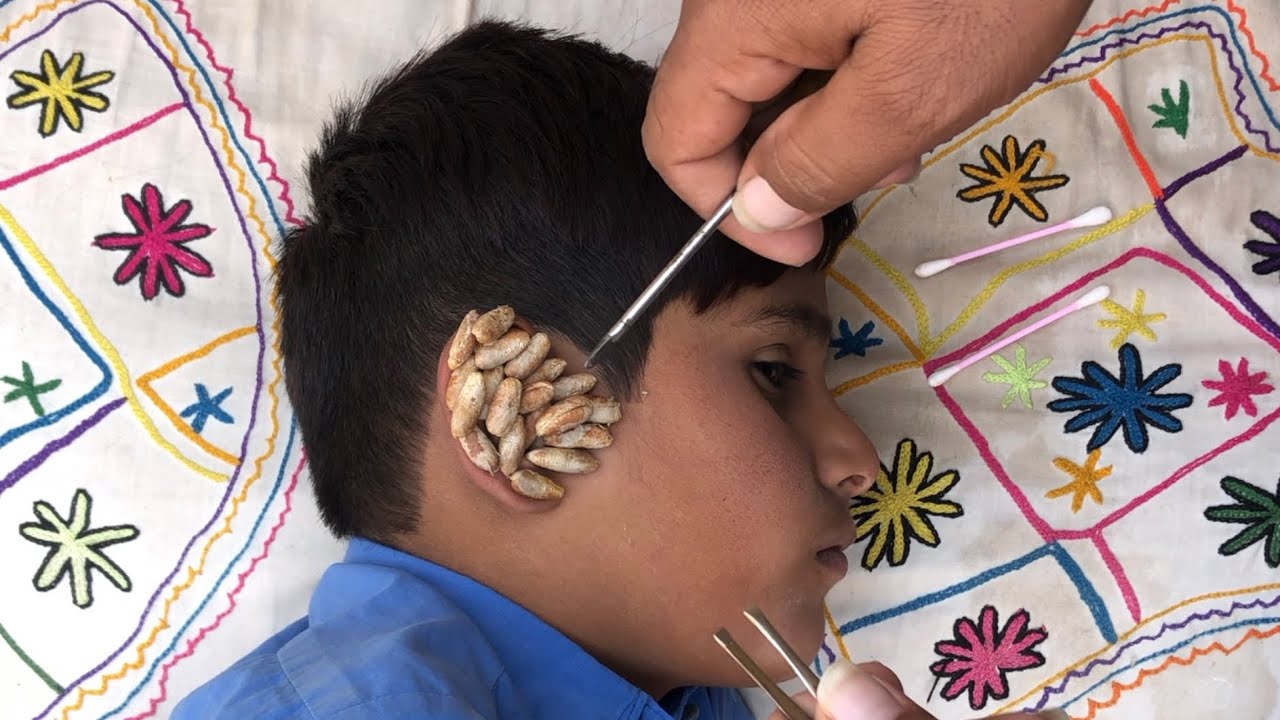 "Ultimate Ear Cleaning ASMR | Sleep & Relax Sounds 