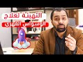 التهيئة لعلاج الوسواس القهري الوسواس القهري 09 