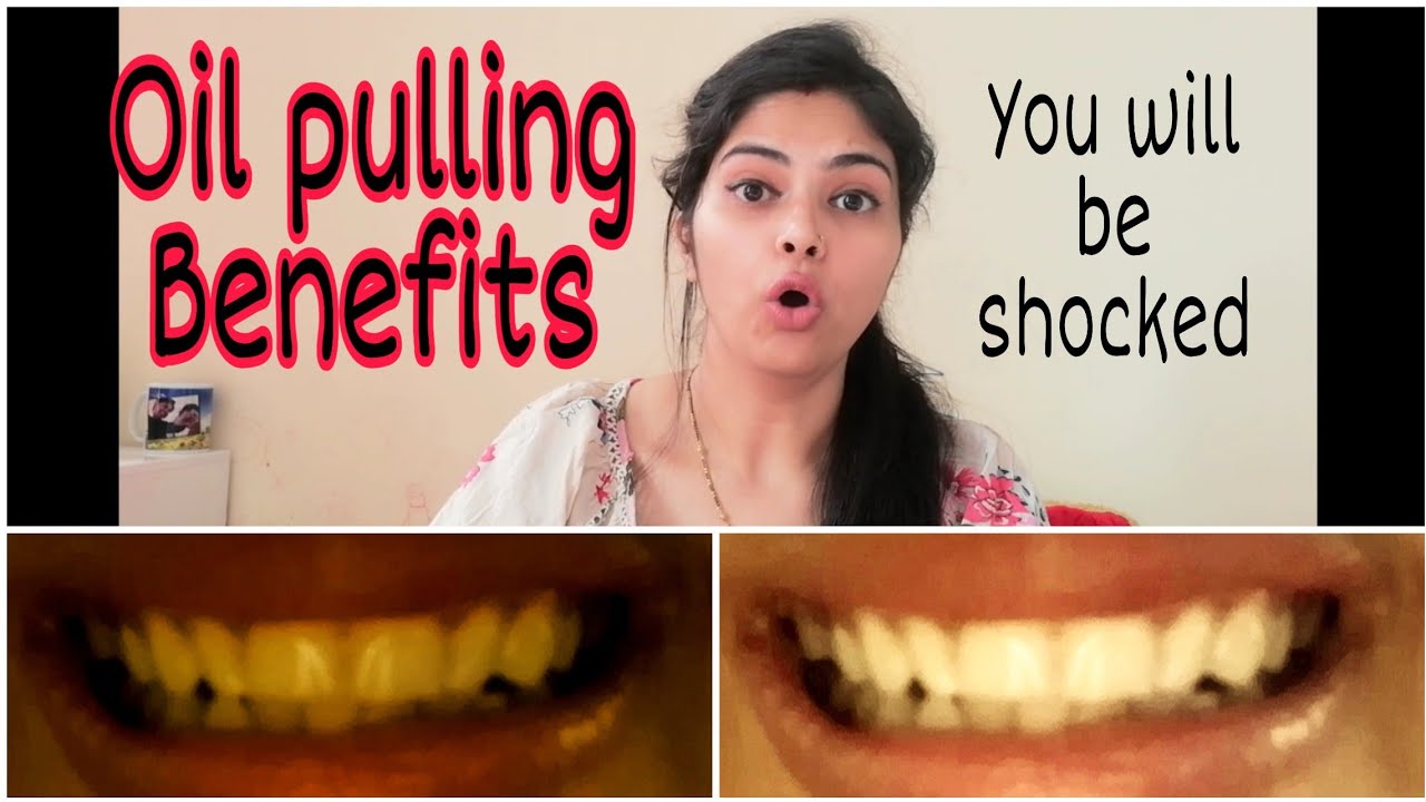 Oil Pulling BENEFITS FOR SKIN, HEALTH,TEETH How to detoxify your