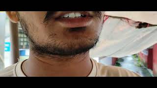 Khub Barish K Baad Kadati Dhup