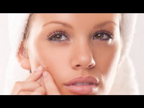 how to get rid of acne / acne during pregnancy HD