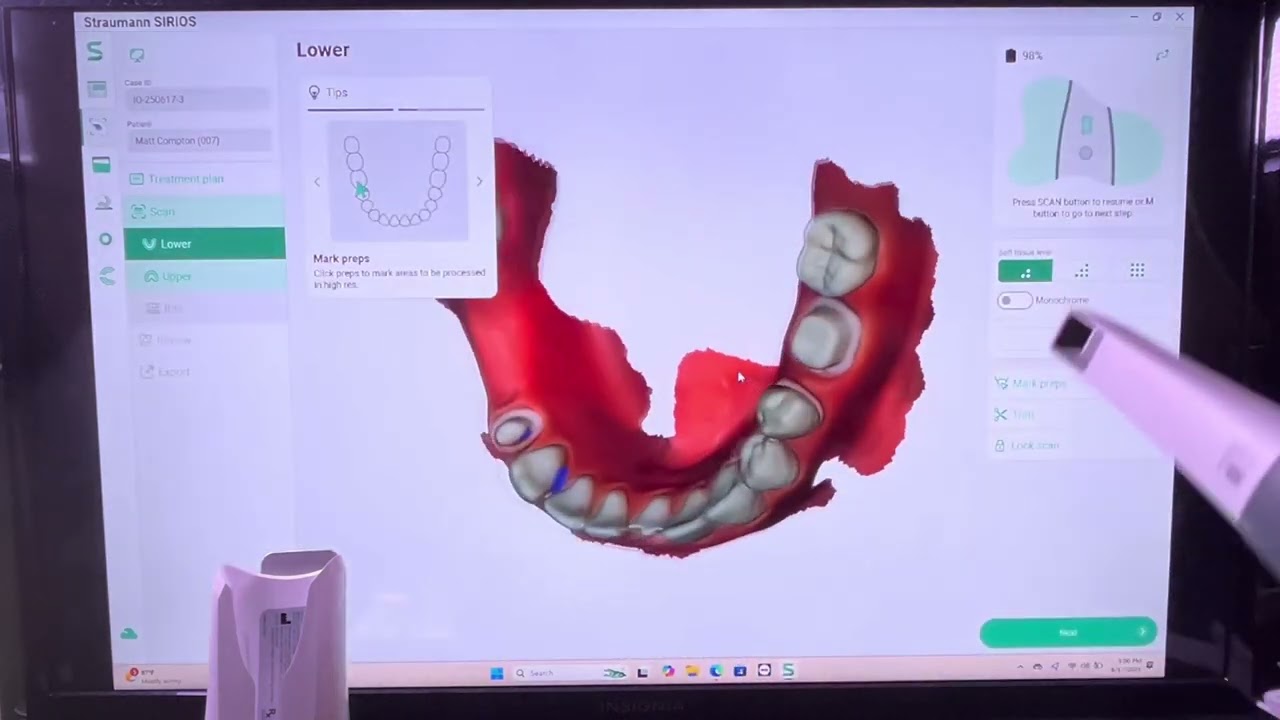 How Straumann Sirios Auto Connects To AXS Portal