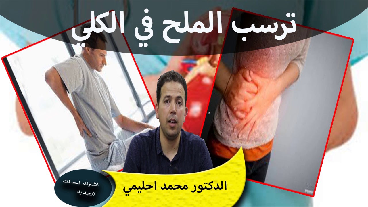 ماهي اسباب ترسب الملح على مستوى الكلي الدكتور محمد احليمي