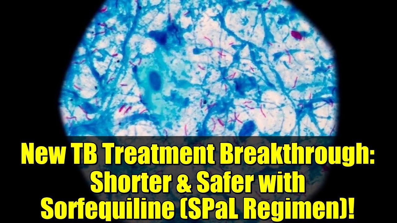 New TB Treatment Breakthrough: Shorter & Safer with Sorfequiline (SPaL Regimen)!
