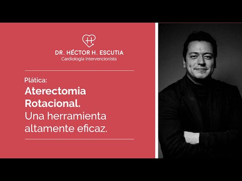 Aterectomia Rotacional. Una herramienta altamente eficaz.