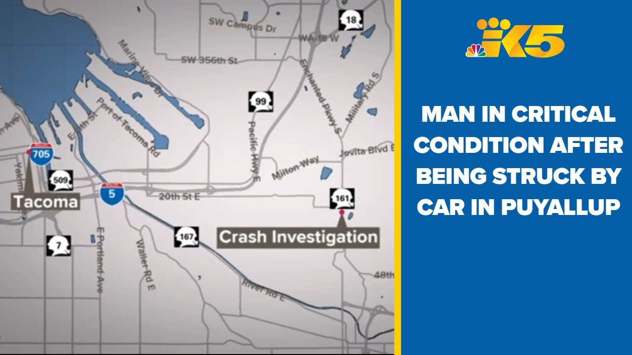 60-year-old man in critical condition after being struck by car in ...