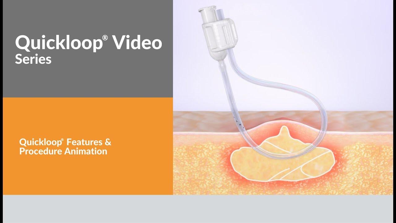Quickloop Abscess Treatment Device YouTube