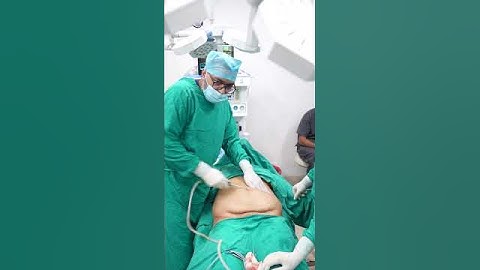 Abdomen Liposuction #liposuction #viralshorts #shorts