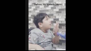 Speech therapy at Abha clinic -kalkaji,Delhi #autism #education #shorts #autismcare #youtubeshorts