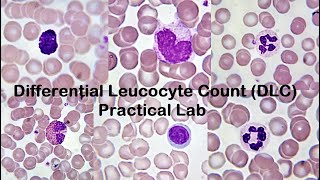 Differential Leucocyte Count DLC Practical Lab