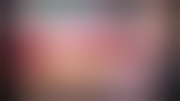 CataractCoach™ 2515: combined iStent and iDose TR for milder glaucoma