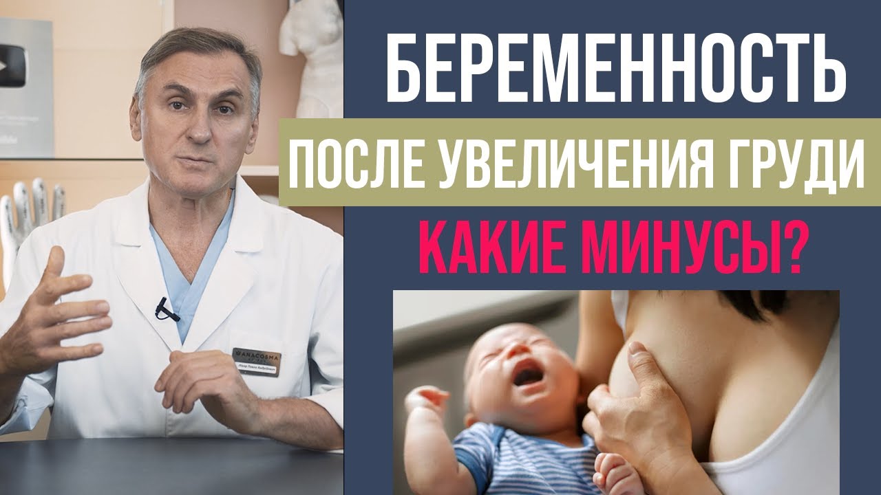 МОЖНО ЛИ КОРМИТЬ ГРУДЬЮ С ИМПЛАНТАМИ? 😳 МАММОПЛАСТИКА ДО РОДОВ - YouTube