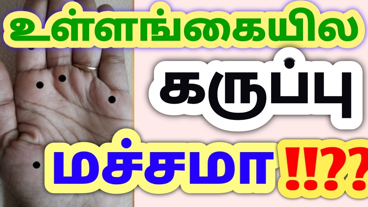 What Do Black Dots Mean On Your Hands Karumpulli Palmistry YouTube
