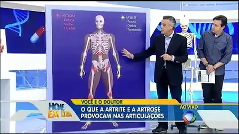 O que a artrose altera?