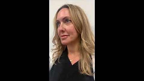Martha Vollure Filler Injections to Her Lips | Dr....
