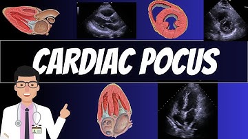 CARDIAC POINT OF CARE ULTRASOUND (POCUS)