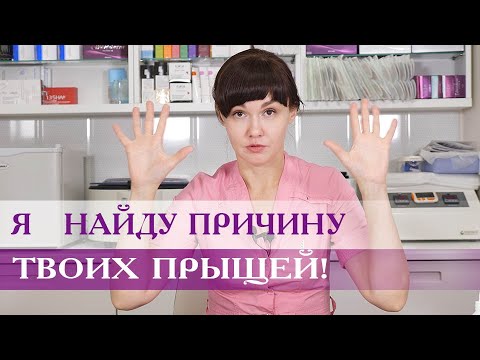 Я найду причину твоих прыщей!