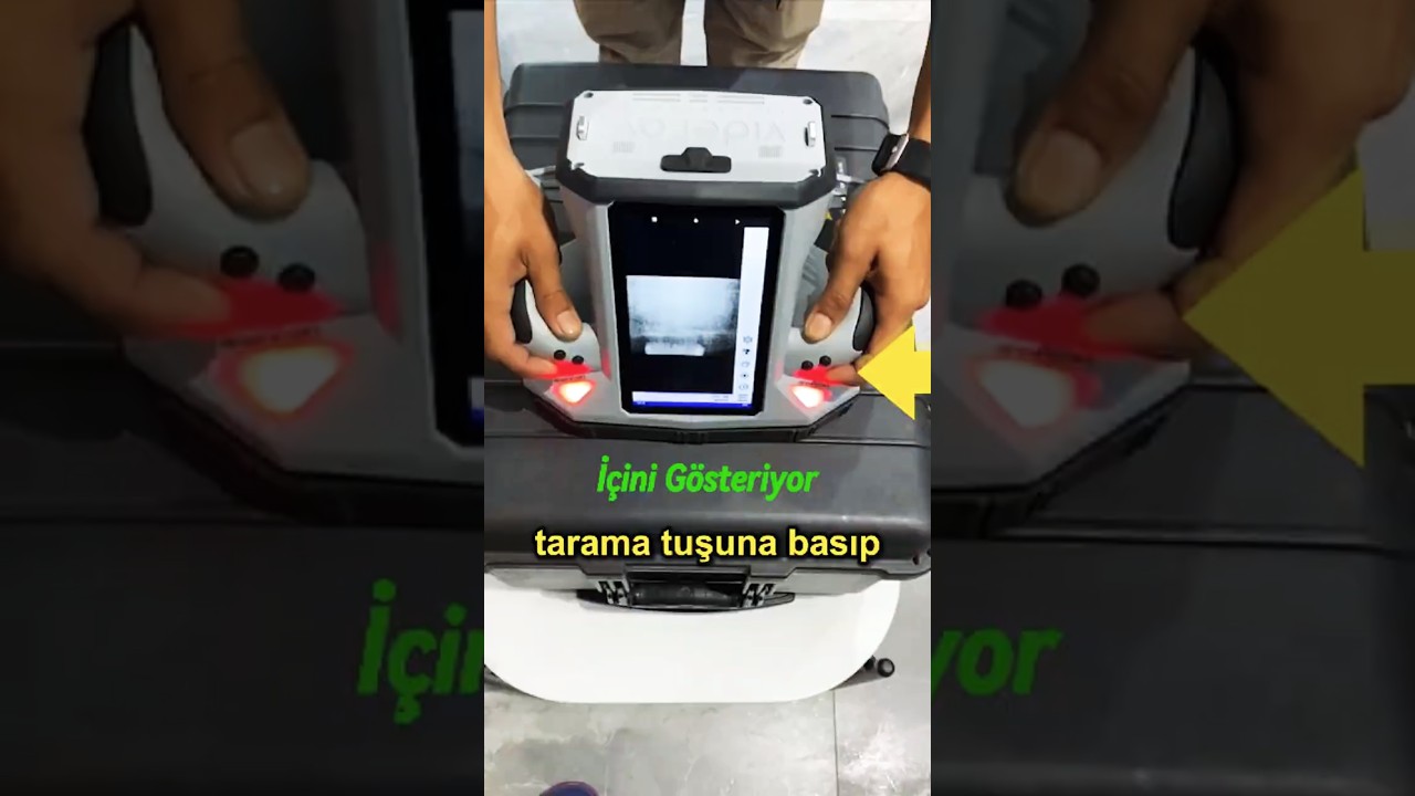 Her Şeyi Gösteren Taşınabilir X-Ray Cihazı 🩻 👀 🤯