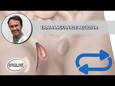 Ernia inguinale recidiva