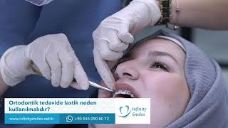 Ortodontik tedavide lastik neden kullanılmalıdır? -  Infinity Smiles Diş Polikliniği