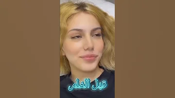 قبل وبعد نارو تسوي فلر شنو رايكم نارو بارق نبأ العراق 