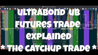 Ultrabond Trade Explained - UB Futures Trading in Jigsaw Daytradr - The Catchup